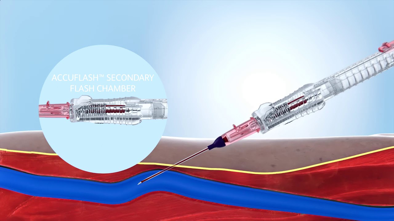 BD AccuCath Ace 1 25 inch Intravascular Catheter Insertion Instructions
