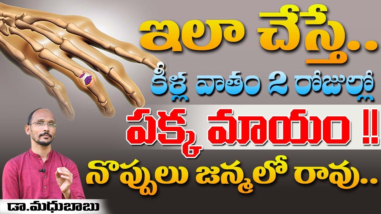ఇలా చేస్తే.. కీళ్ల వాతం 2 రోజుల్లో పక్క మాయం | Dr. MadhuBabu | Health Trends |