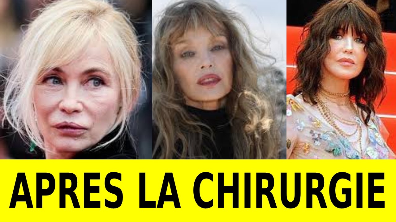 10 actrices françaises dont le visage a été transformé par la chirurgie esthétique