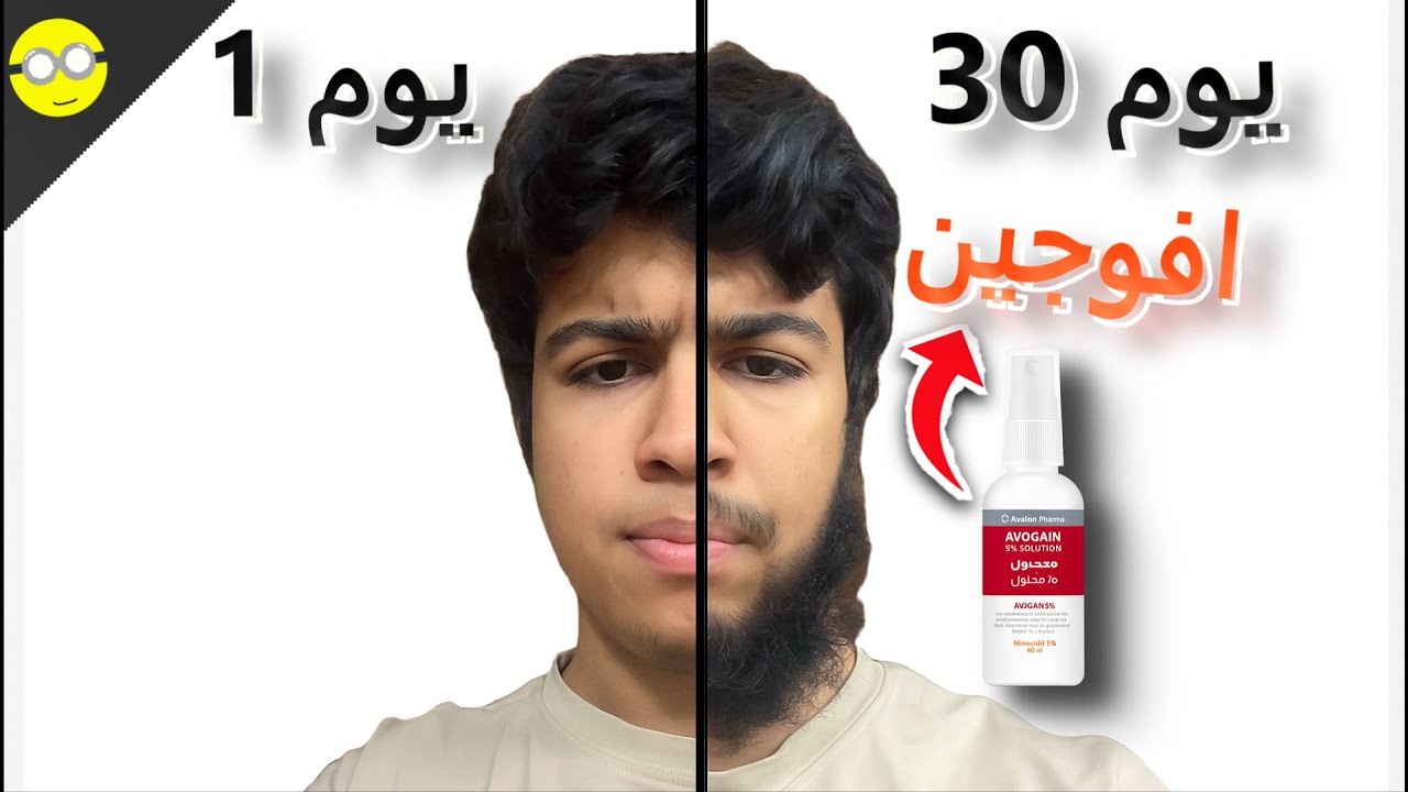 جربت الافوجين لمده 30 يوم (يخلي الشعر يرجع مره ثانيه !!)