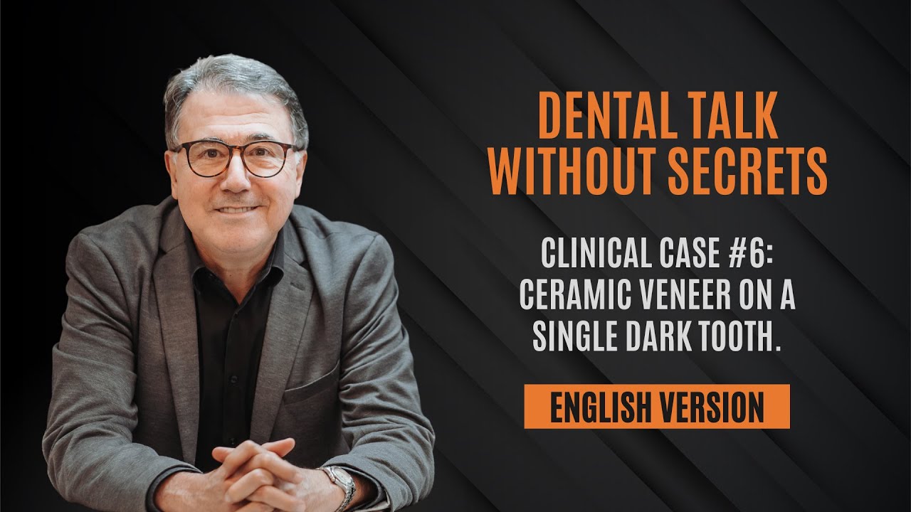 Clinical Case #6: Ceramic veneer on a single dark tooth.