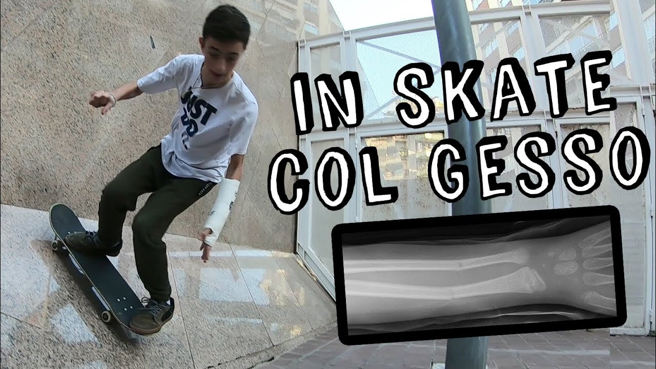 in skate col Gesso