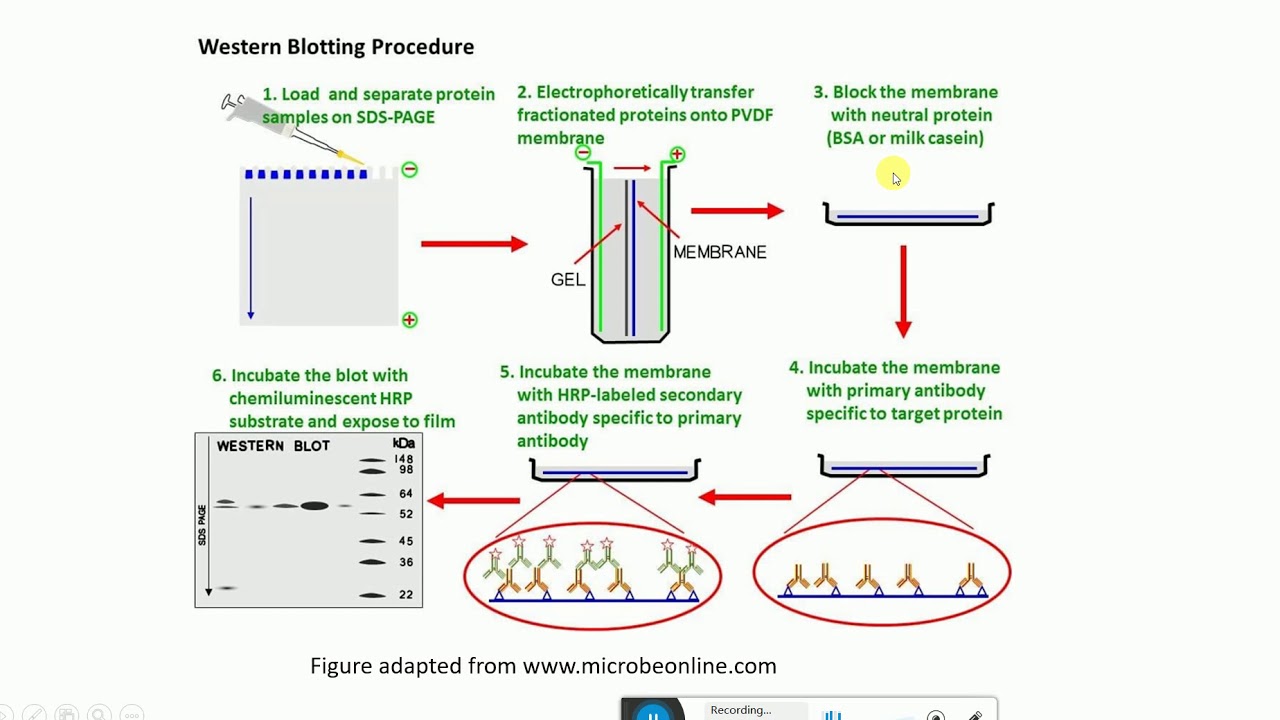 Western blotting | Western Blot Analysis | What is Western blot analysis |