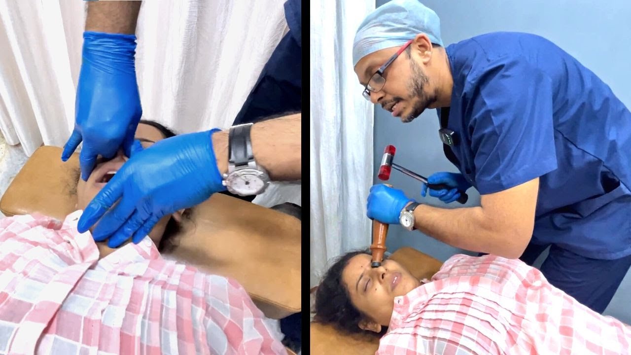 KNOCKING Out HEADACHE With Expert Chiropractic Techniques for Nasal Realignment