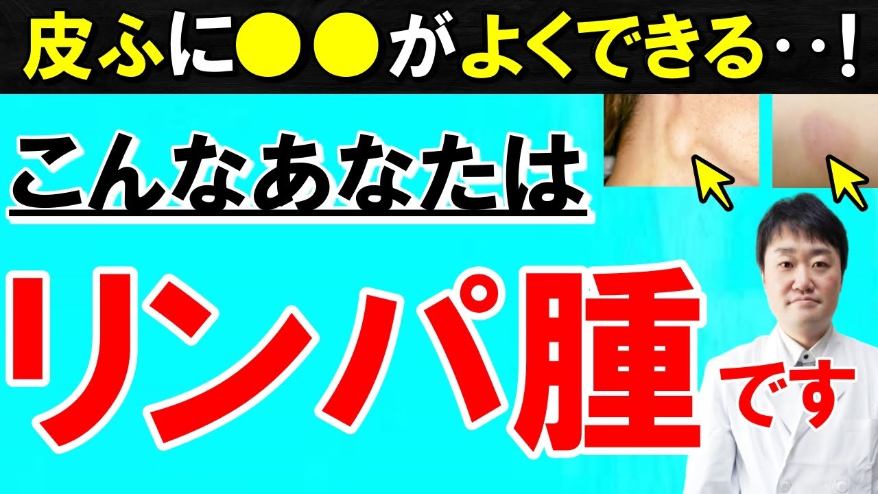 【放置禁止】日本で急増する血液がん「悪性リンパ腫」の7つの初期症状　しこりだけでなく起こる皮ふ等の変化とは？　専門医師がくわしく解説