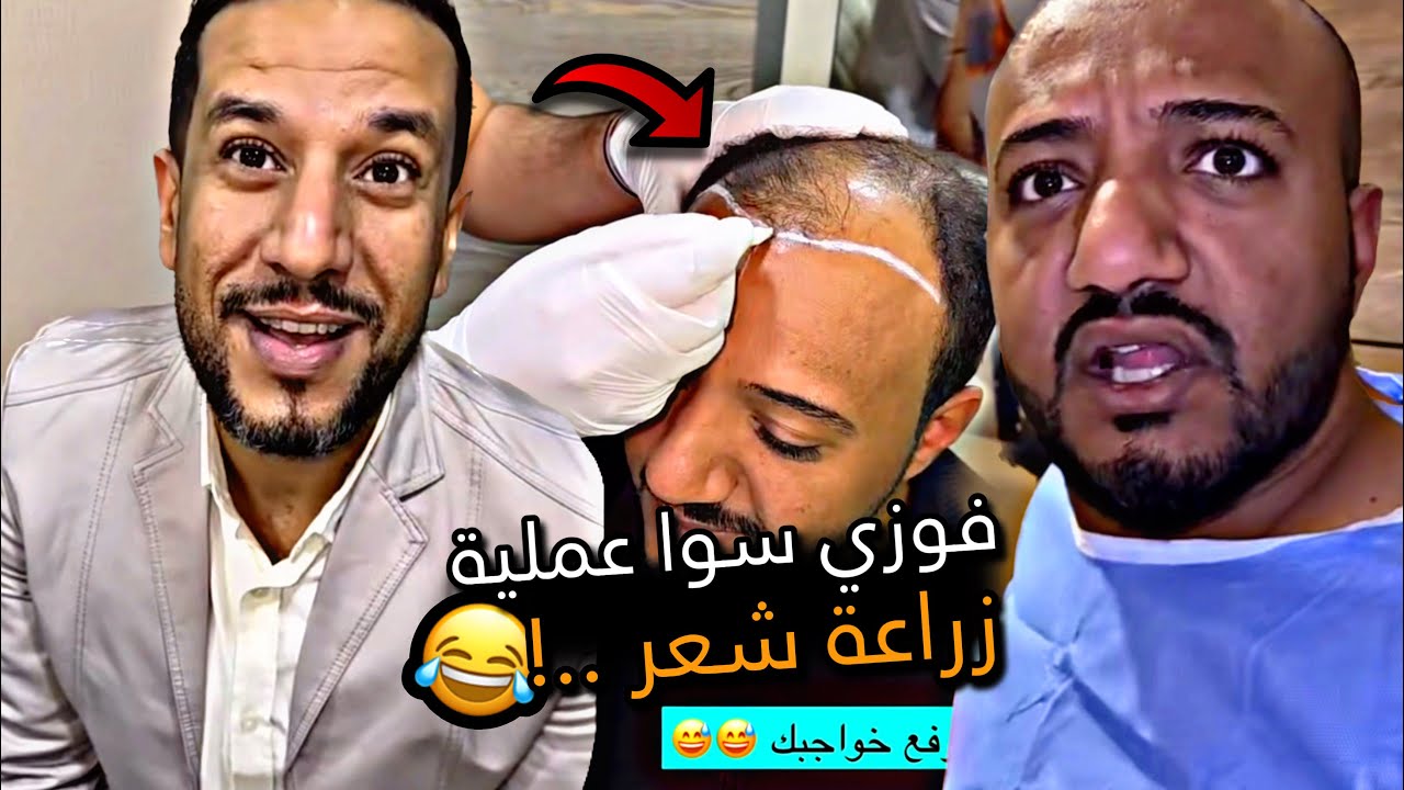 فوزي سوا عملية زراعة شعر 🤣🔥 | سنابات باسم