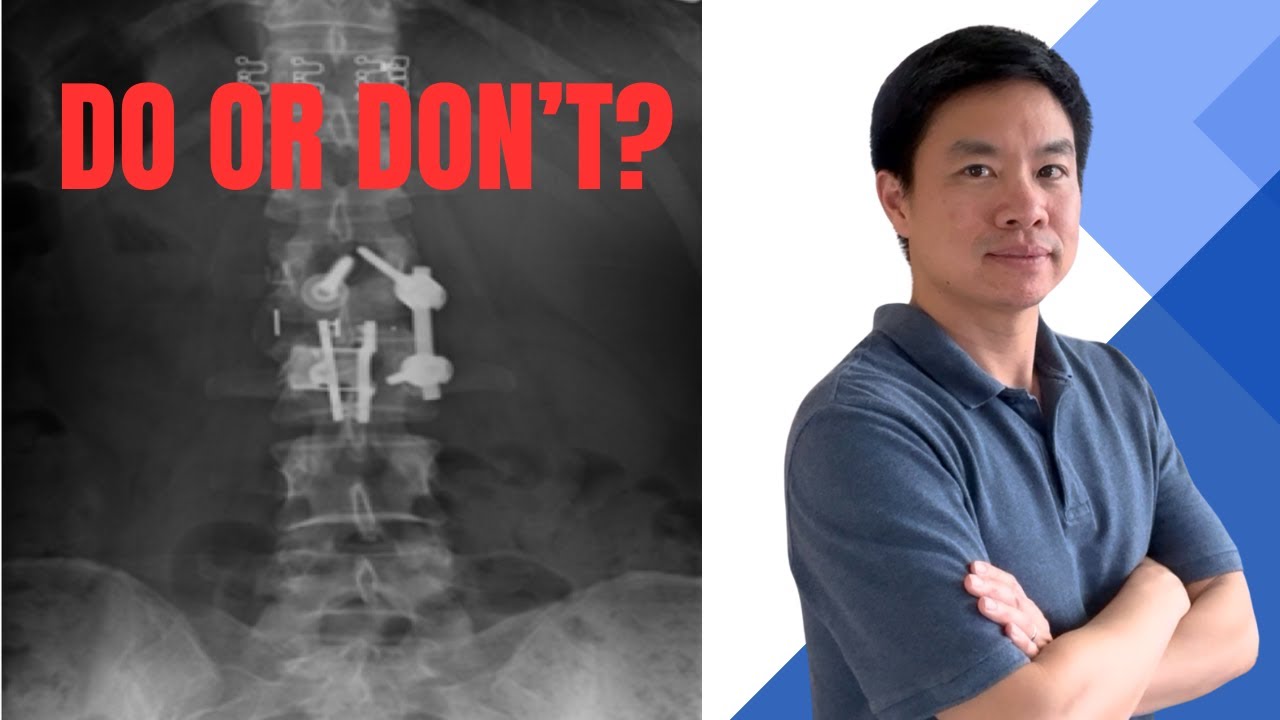 Do You Really Need Back Surgery? 3 Signs It (Might Be) Time