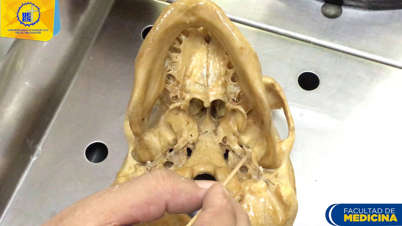 Fosa infratemporal  - Dr. Ernesto Hurtado
