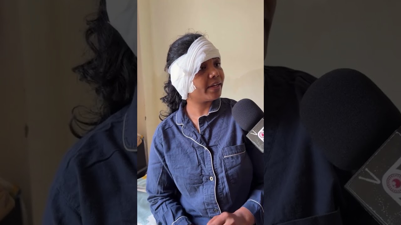 The Delhi Police have denied using pellet guns however protesters have claimed injuries from pellets