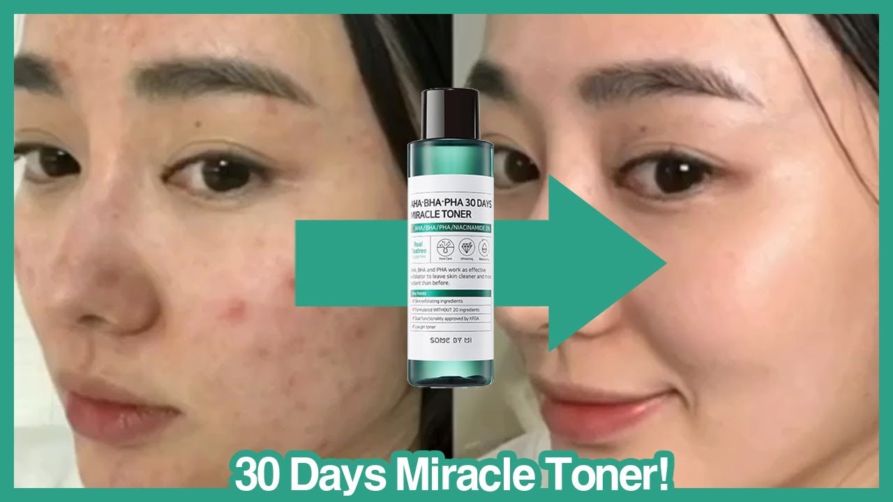 [SOME BY MI] AHA BHA PHA 30 Days Miracle Toner