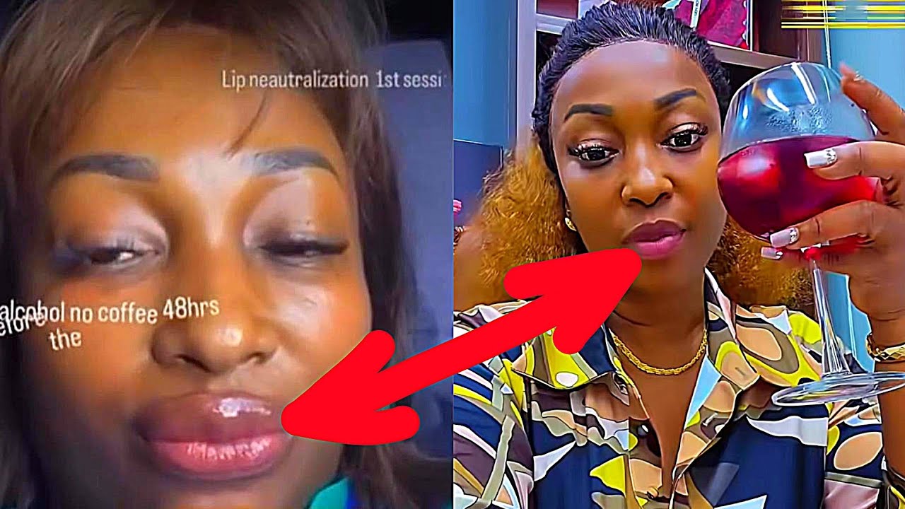 VIDEO MASHABIKI WAMLIPUA AUNT EZEKIEL KUFANYA SURGERY YA MDOMO 