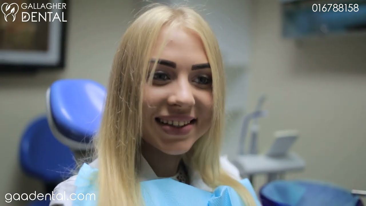 Tooth Whitening Dublin 2 - Gallagher Dental