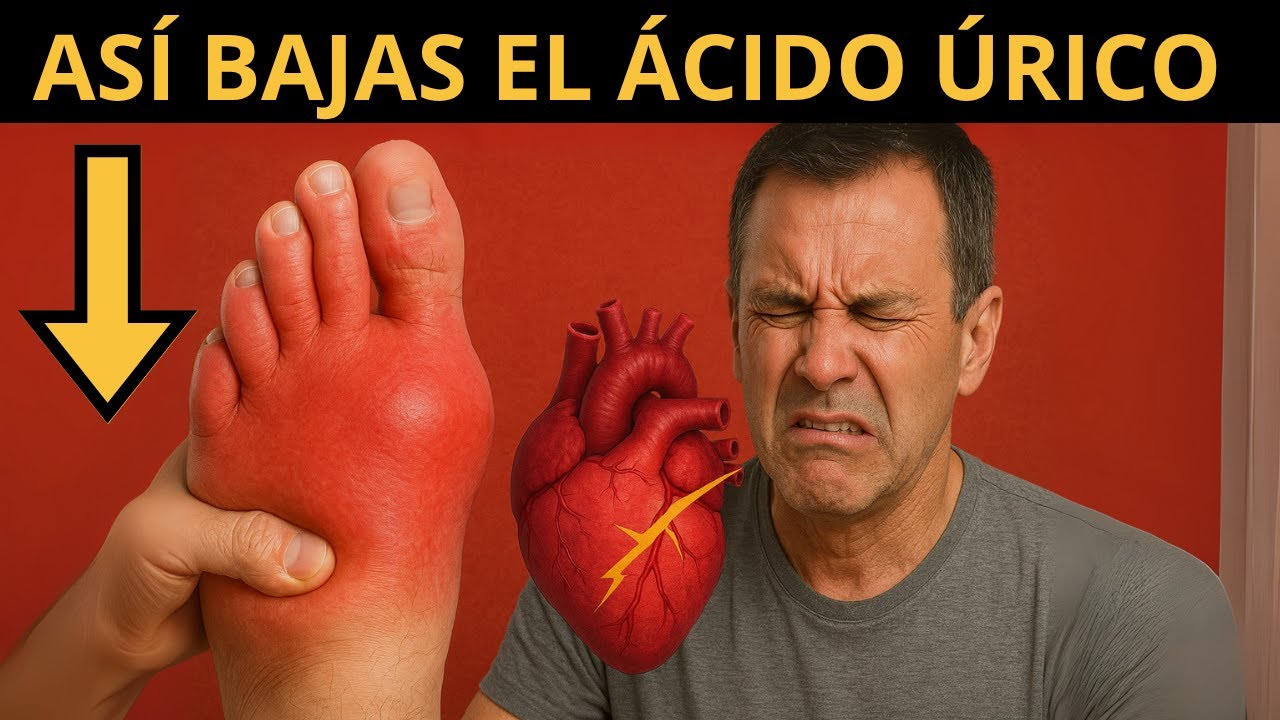¿Tienes el ÁCIDO ÚRICO elevado? Todo esto produce