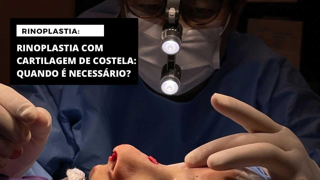 RINOPLASTIA COM CARTILAGEM DE COSTELA QUANDO É NECESSÁRIO