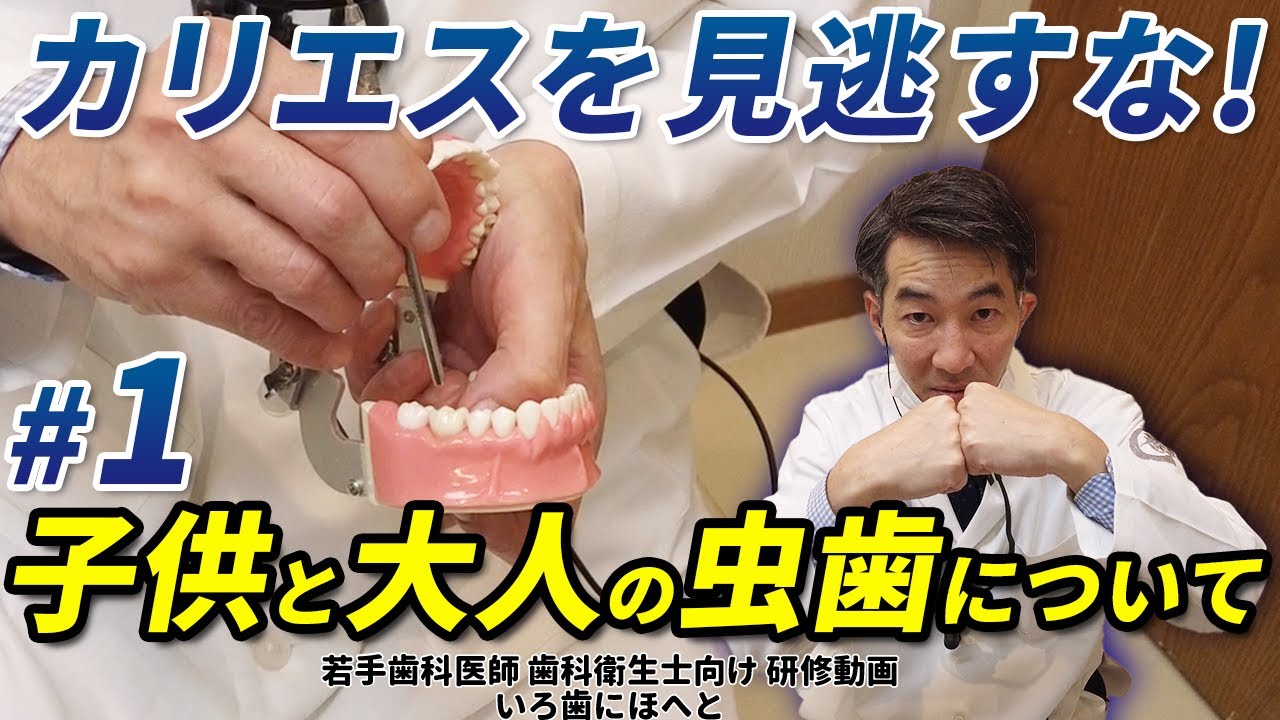【カリエスを見逃すな！#1】虫歯の原因から考える見落とし予防法・子供と大人の虫歯の差
