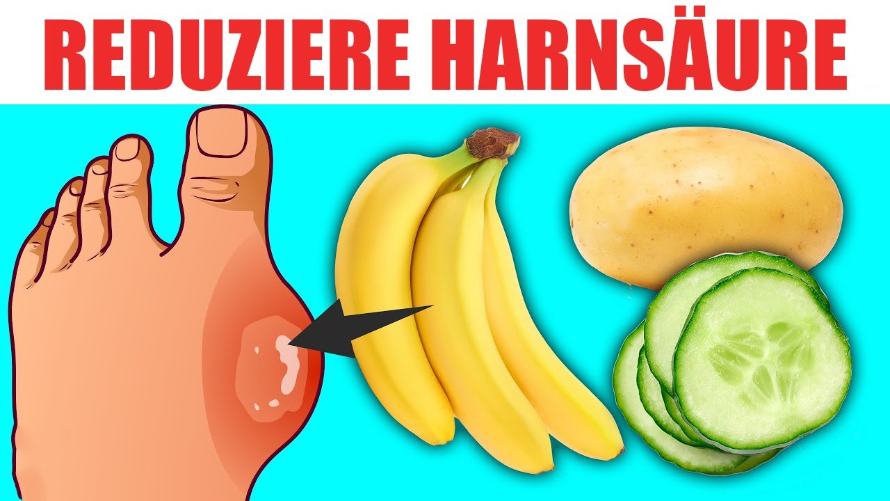 10 Lebensmittel  die deine Harns&auml;ure senken