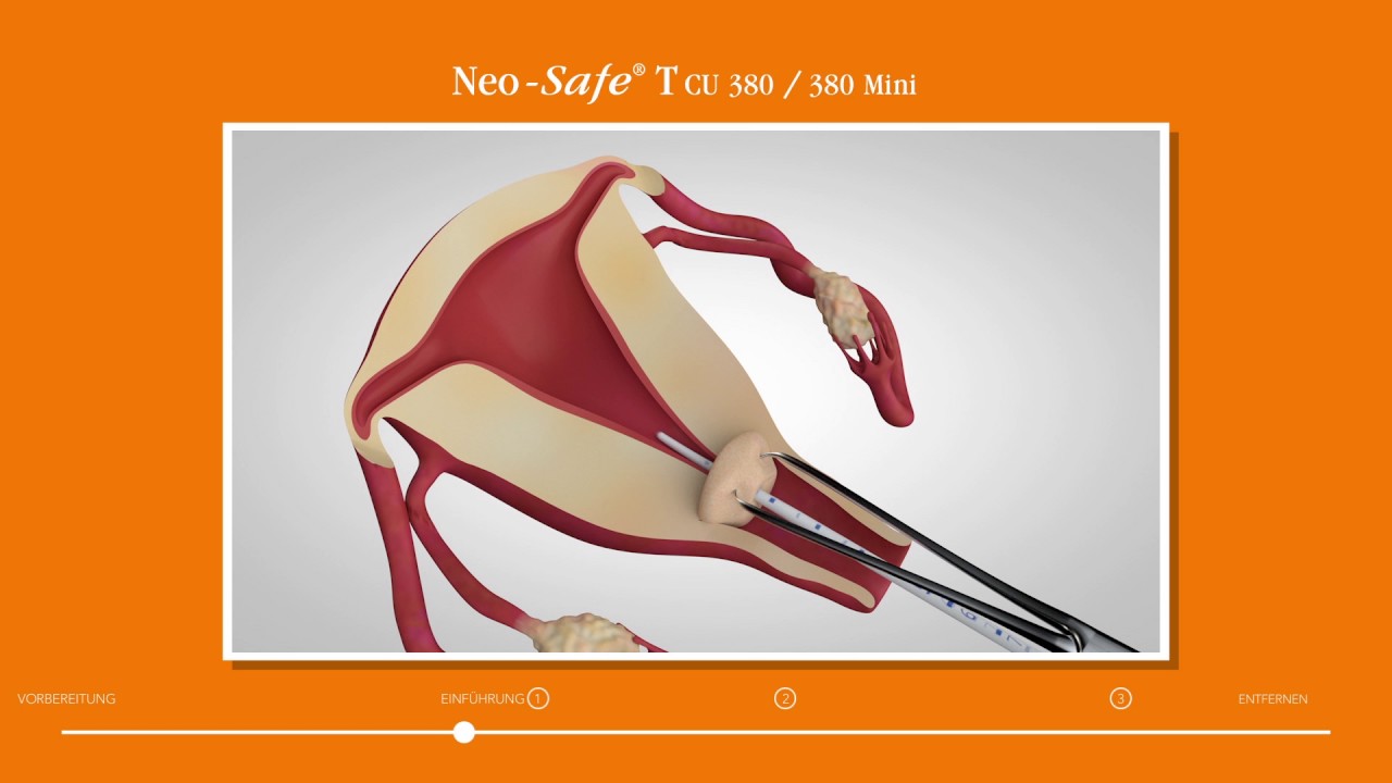 Neo-Safe T CU 380/380 Mini Einführanleitung