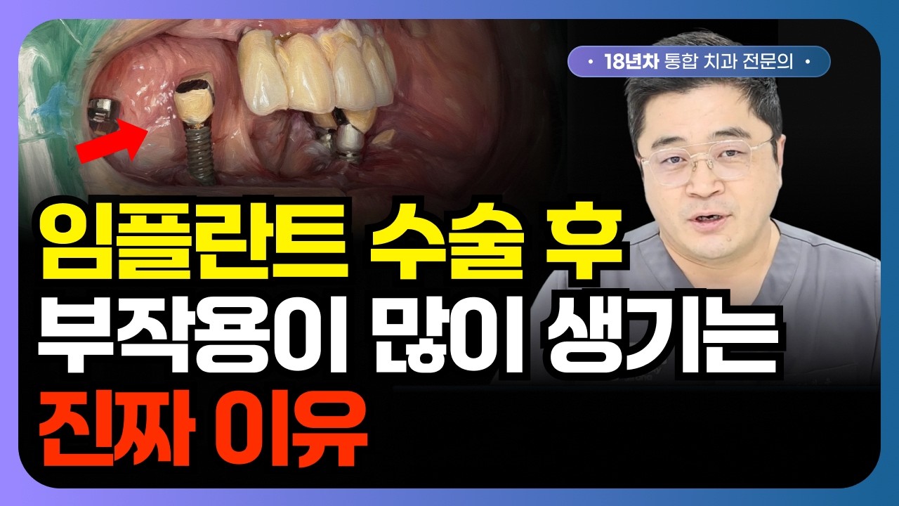 임플란트 후 통증, 악취의 원인은 ‘이것’ 때문입니다.