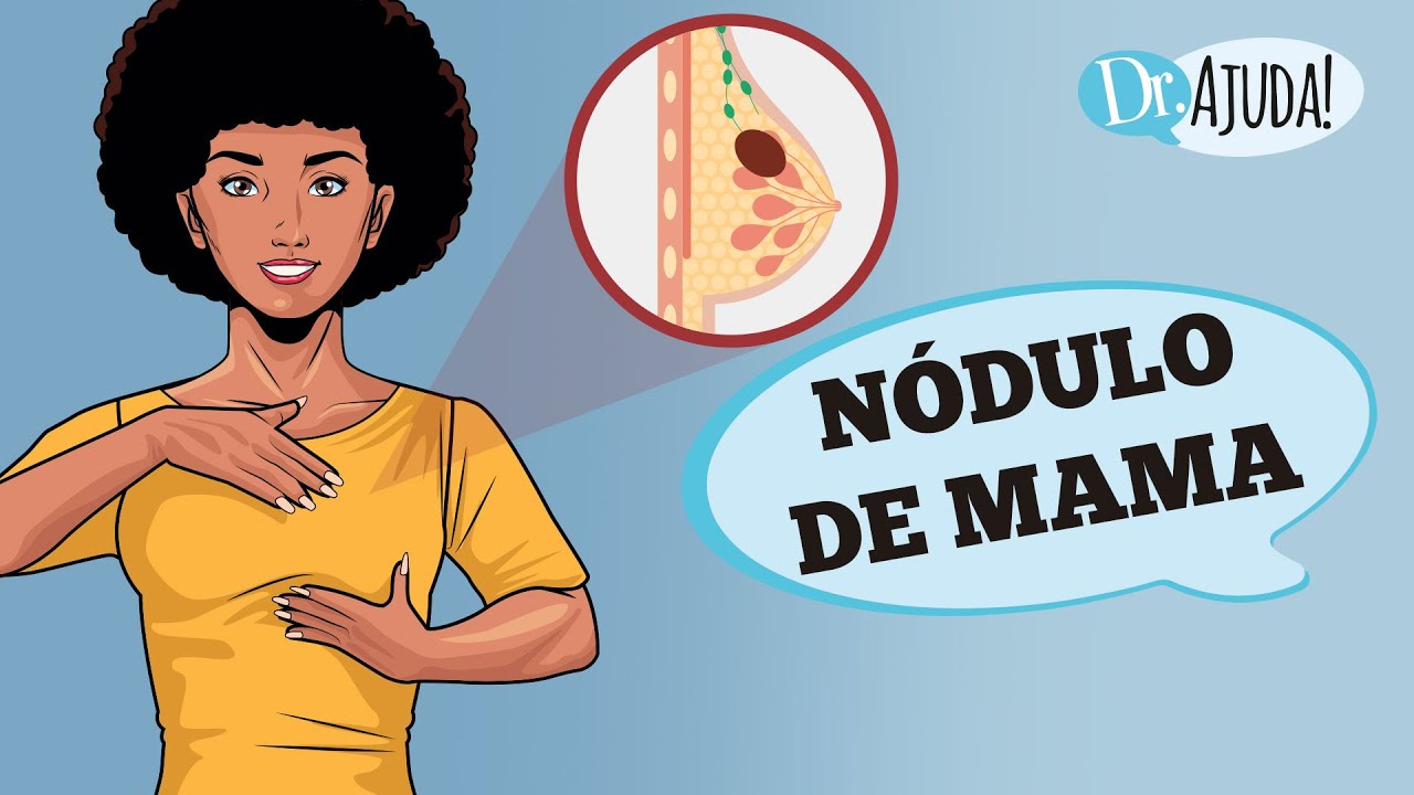 NÓDULO DE MAMA: É BENIGNO OU CÂNCER DE MAMA? COMO É O DIAGNÓSTICO E TRATAMENTO?