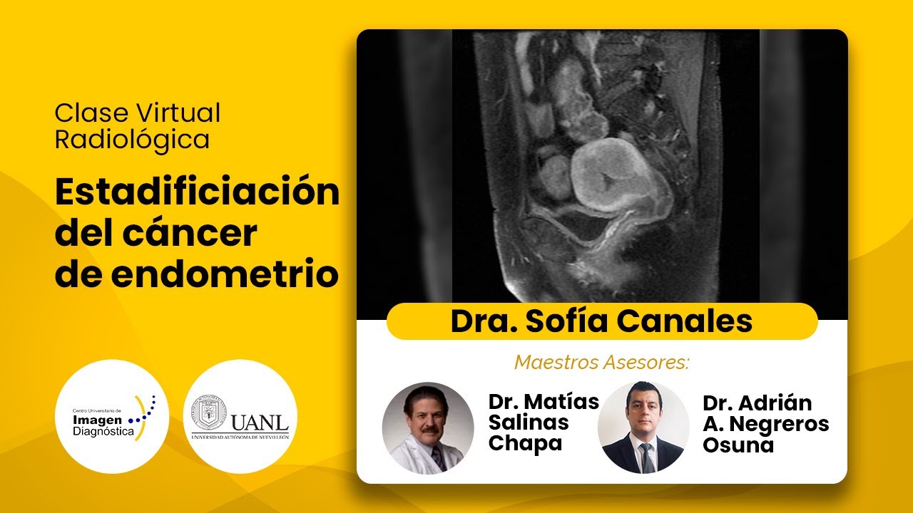 Estadificación cáncer de endometrio Dra. Sofía Canales