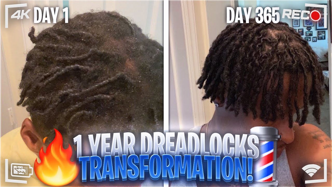 1 YEAR DREADLOCK JOURNEY #dreadlocks #journey