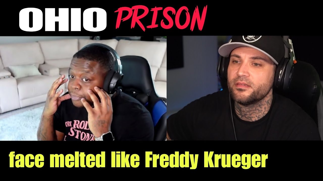 OHIO PRISON - FACE MELTED OFF WHILE SLEEPING