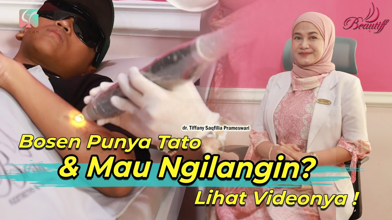 Menghapus Tato Permanen Tanpa Bekas! Penasaran?
