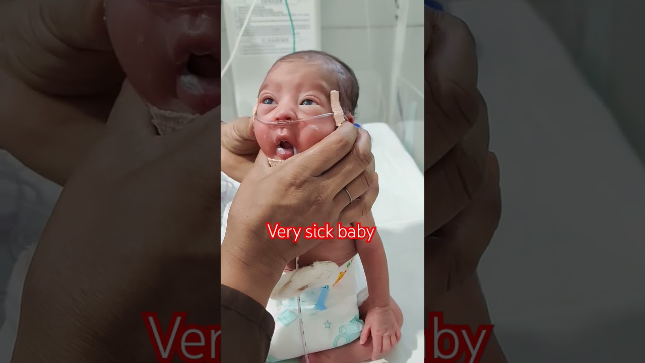 very sick condition New born baby girl 😍🥰 