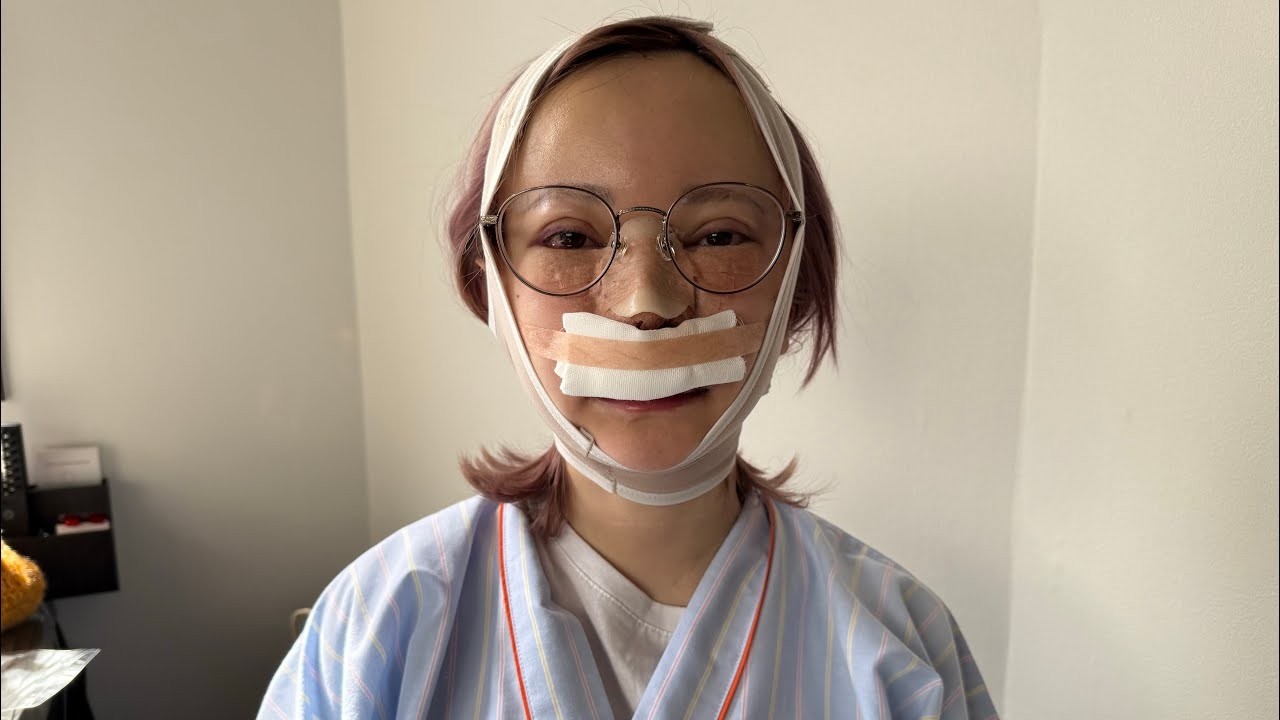 まりなの顔面が大変な事になりました。