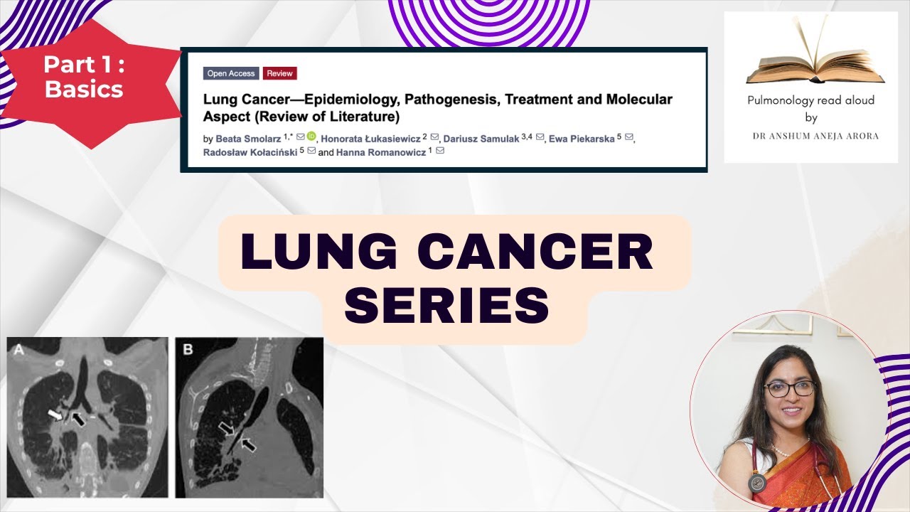 Lung Cancer BASICS: Epidemiology, Pathogenesis & Molecular Markers &ndash; A Read-Aloud  Series PART 1