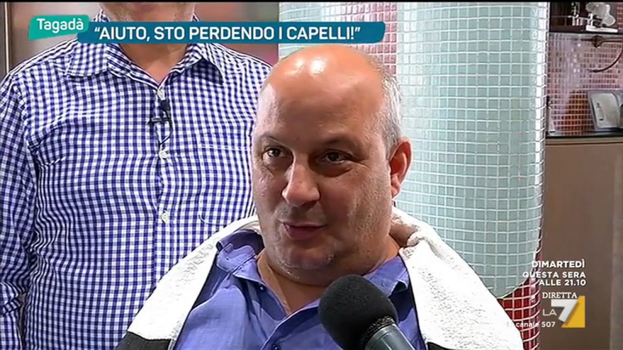 'Aiuto, sto perdendo i capelli'