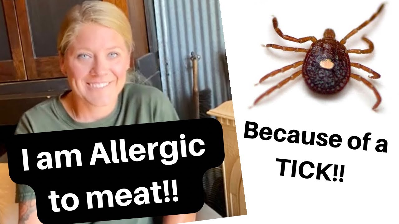 I have Alpha Gal Syndrome from a Lonestar Tick!!