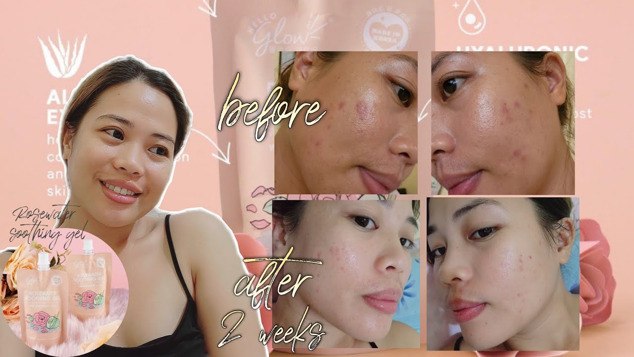 I TRY USING ROSEWATER SOOTHING GEL |2 WEEKS RESULT by Hello Glow | Effective ba? |Joahna Joy