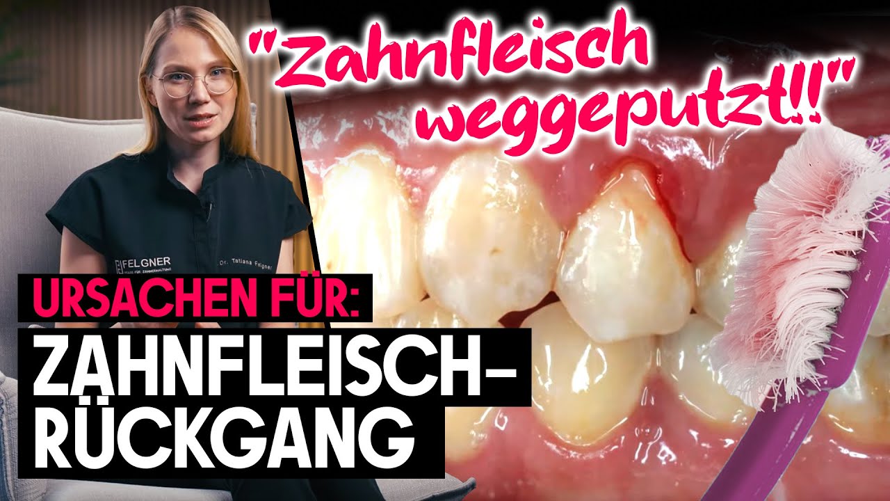 Leider die häuftigste Ursache für Zahnfleischrückgang, die aber (oft) schnell zu vermeiden ist!