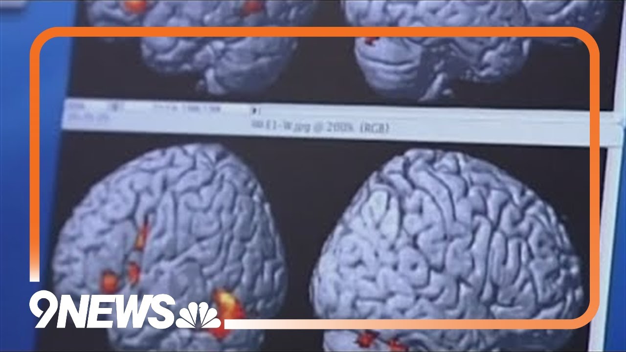 Muscle mass can affect brain health