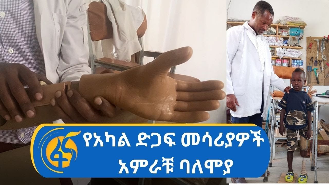 የአካል ድጋፍ መሳሪያዎች አምራቹ ባለሞያ
