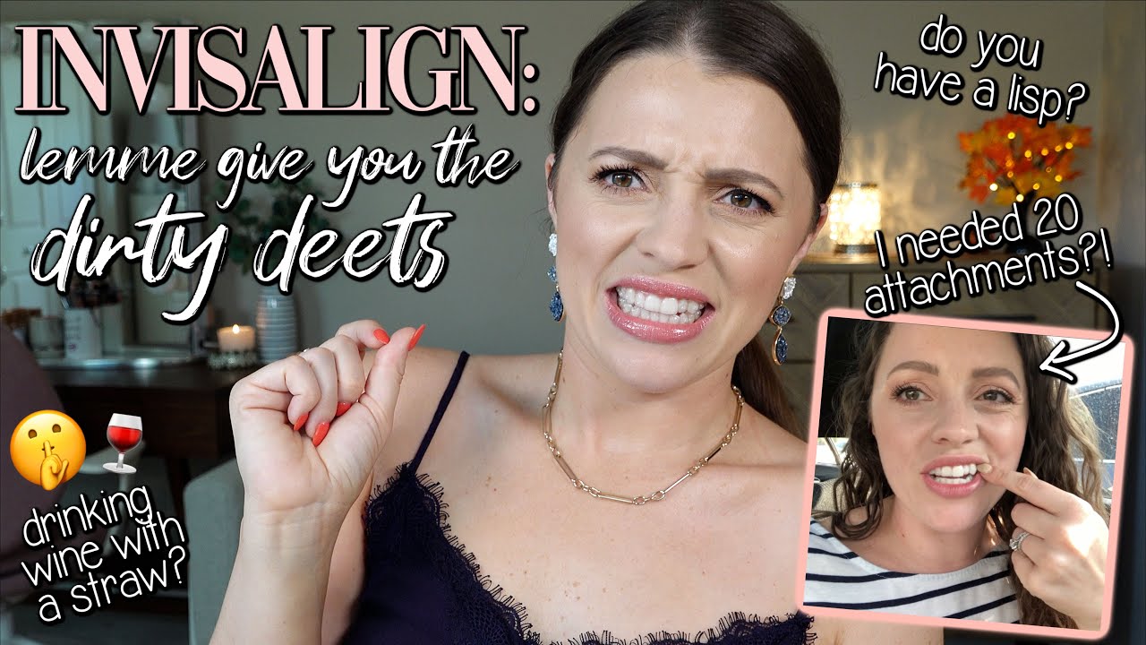 INVISALIGN PROCESS // What it's REALLY like + my sneaky tips!