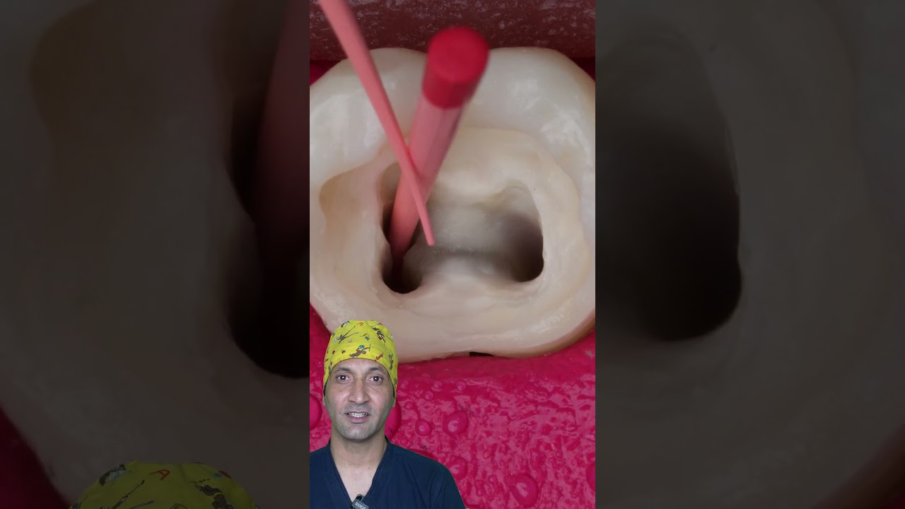 Dentist Root Canal Treatment ASMR #satisfying #asmrvideo