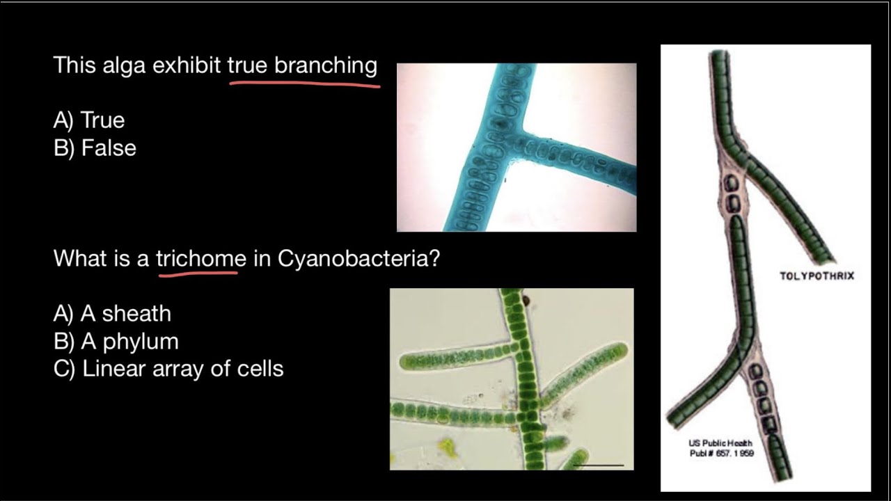 Cyanobacteria | True False Branching | Filament | Trichome