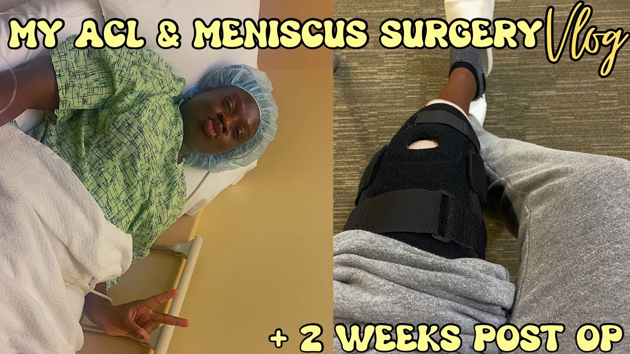 My ACL & Meniscus Surgery Vlog + 2 weeks Post OP