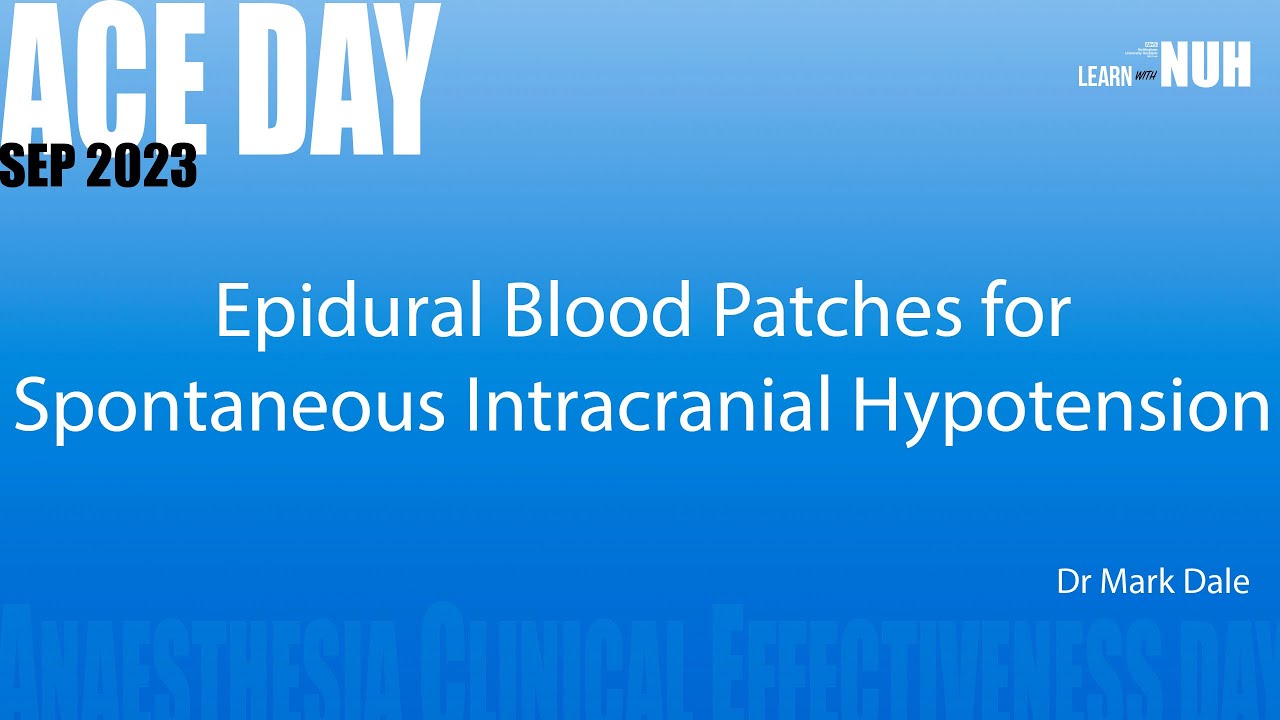 Epidural Blood Patches for Spontaneous Intracranial Hypotension