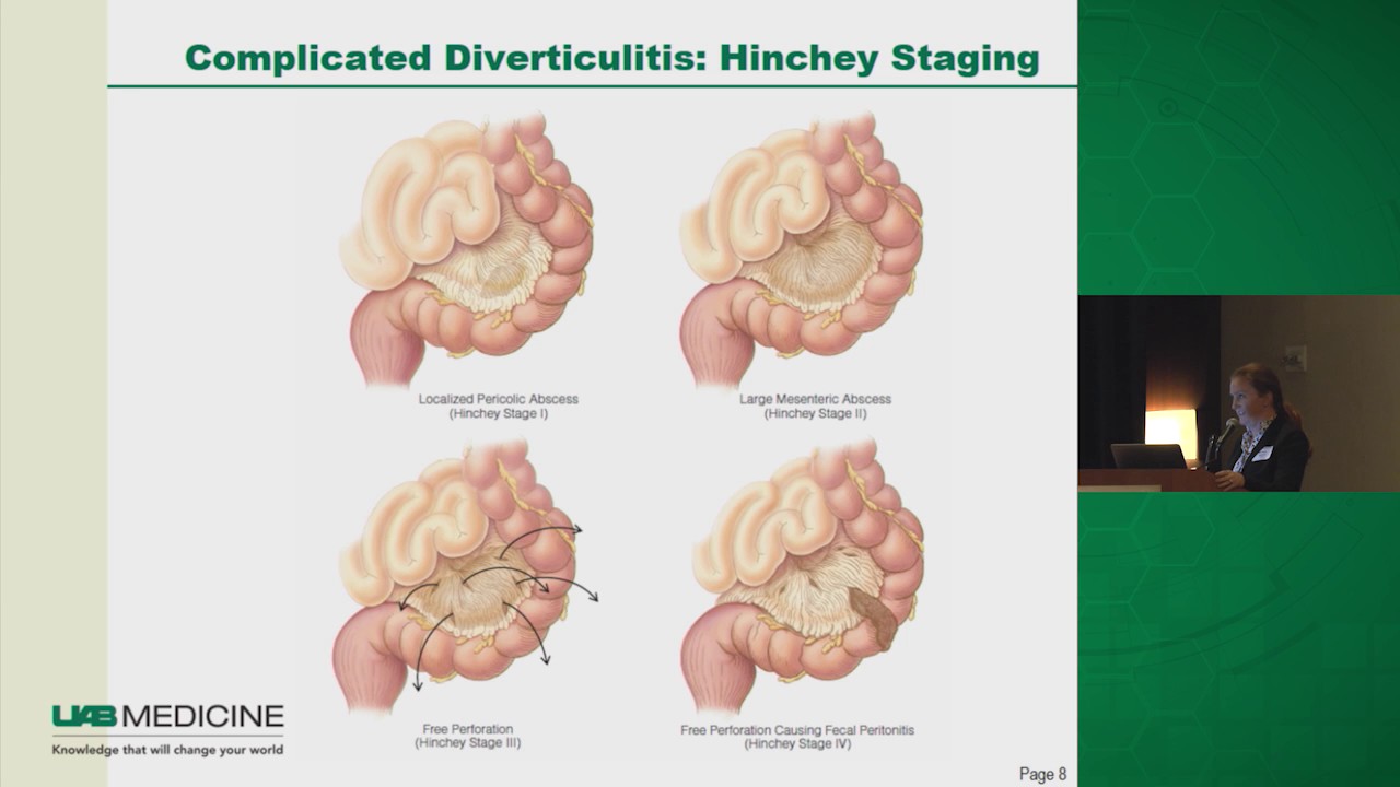 Diverticulitis: To Operate or Not?