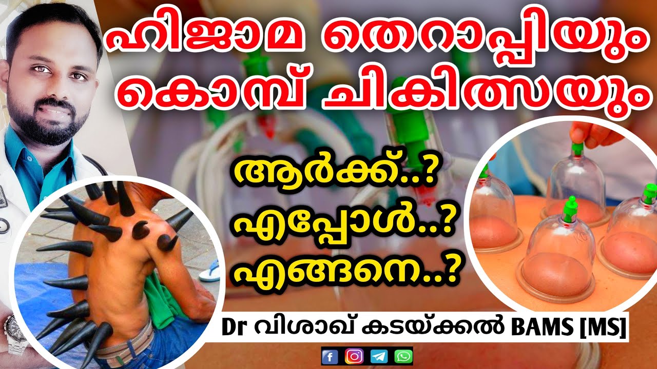 Hijama Treatment Malayalam | ഹിജാമ ചികിത്സ | Hijama Cupping Treatment | Dr Visakh Kadakkal
