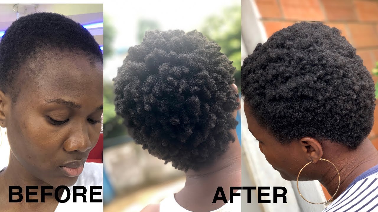 Five Months Natural Hair Growth Post Shave /Timelapse (4c hair) Twa