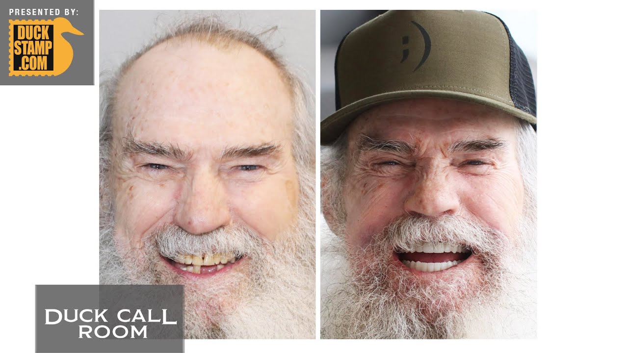 New Smile, New Uncle Si! | Duck Call Room #495