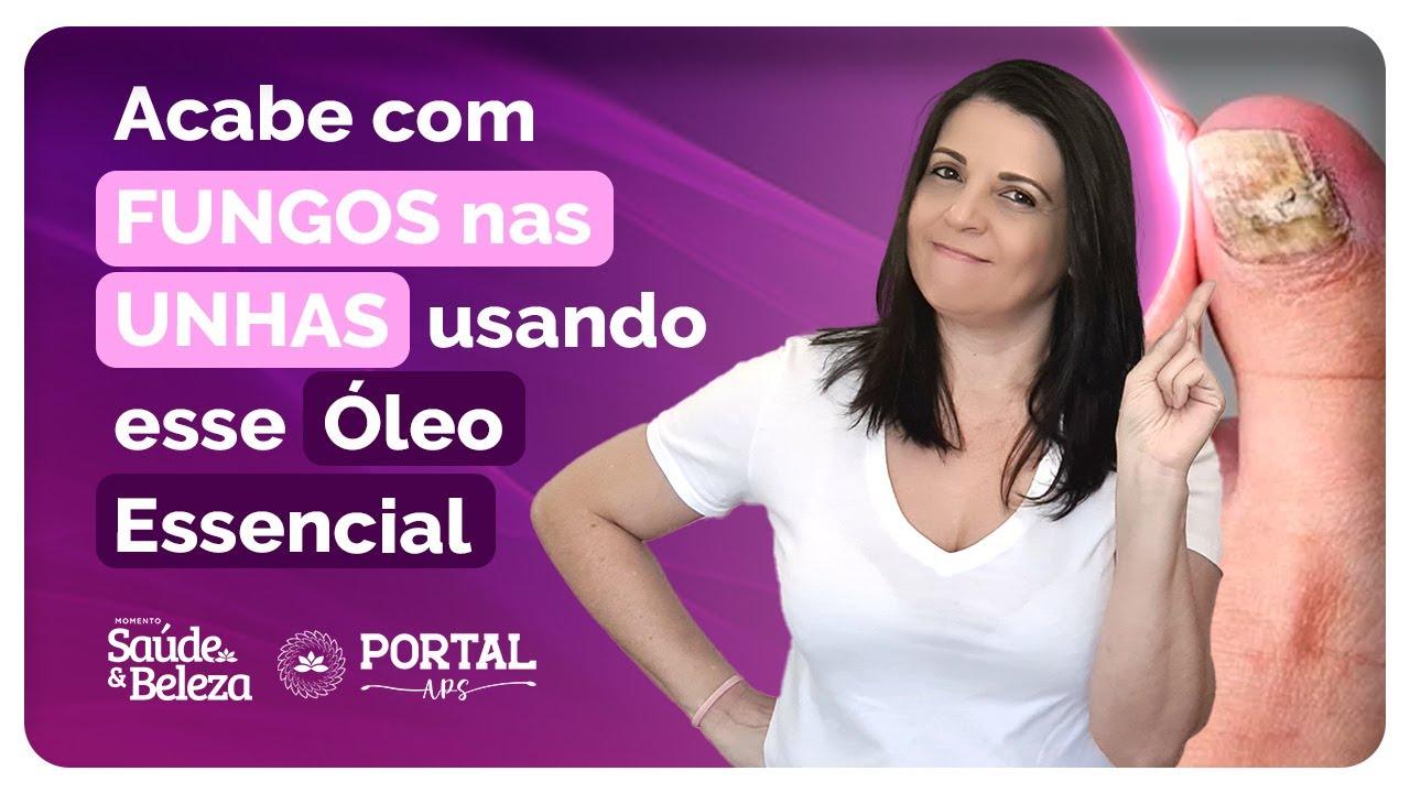 Fungo nas UNHAS nunca mais usando esse Óleo Essenciais | Momento Beleza e Saúde
