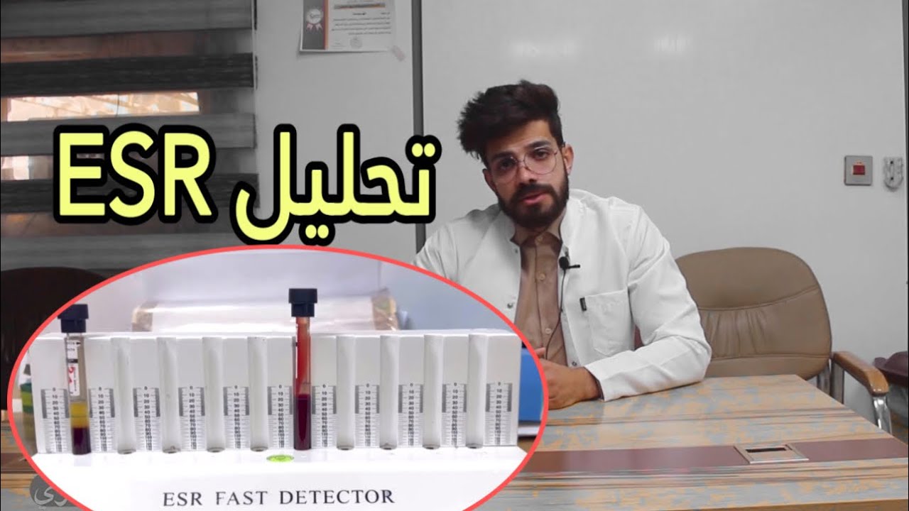 شرح كامل لتحليل ESR وطريقة العمل في المختبر .الاستاذ علي السماري