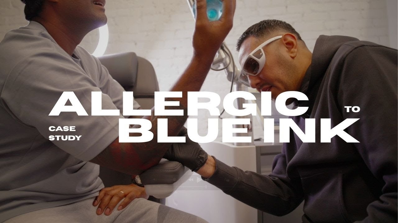 How we treat an allergic reaction to blue tattoo ink | Laser tattoo removal