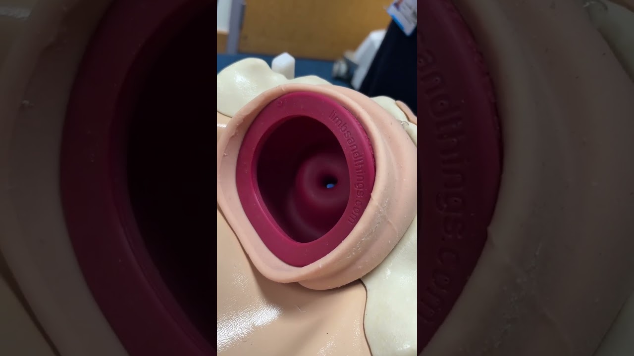 How to insert a cooks balloon 