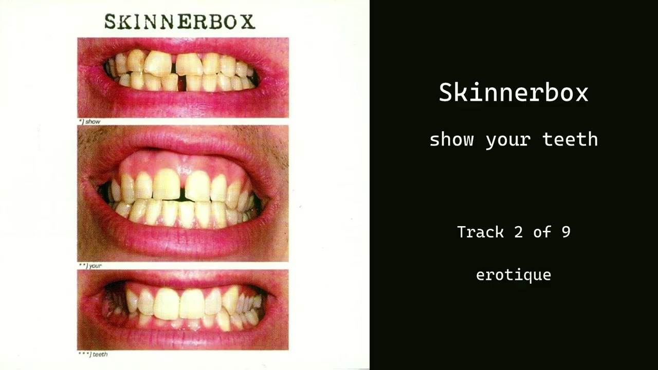 Skinnerbox – erotique